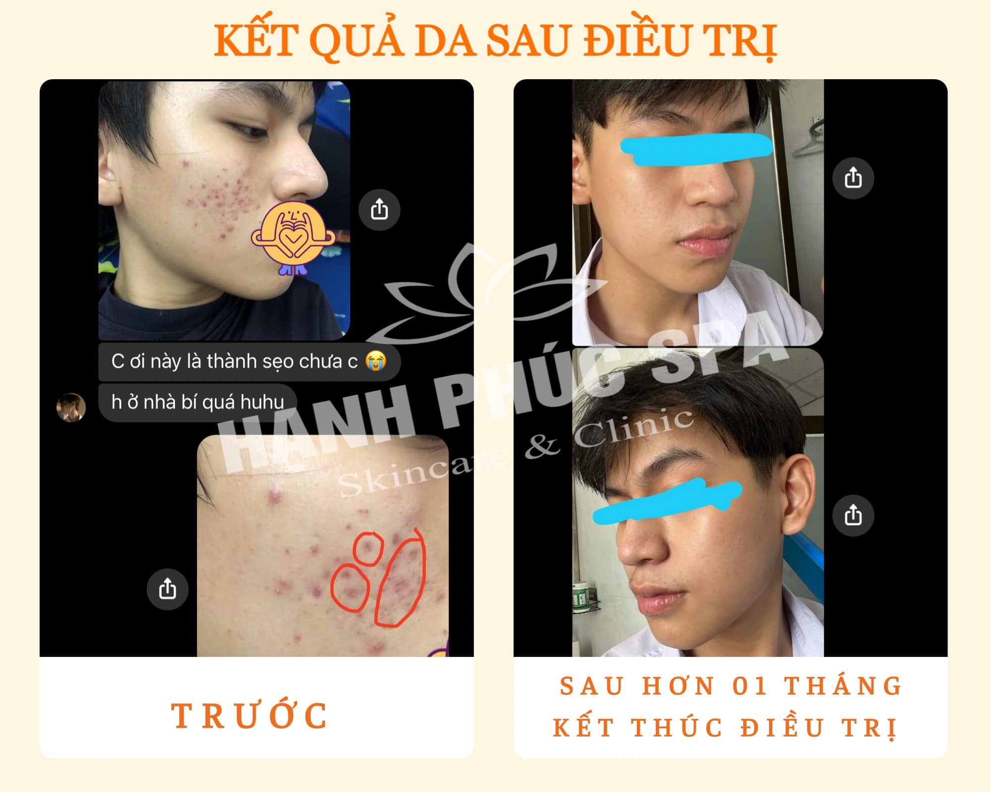 Hạnh Phúc Spa ảnh 2