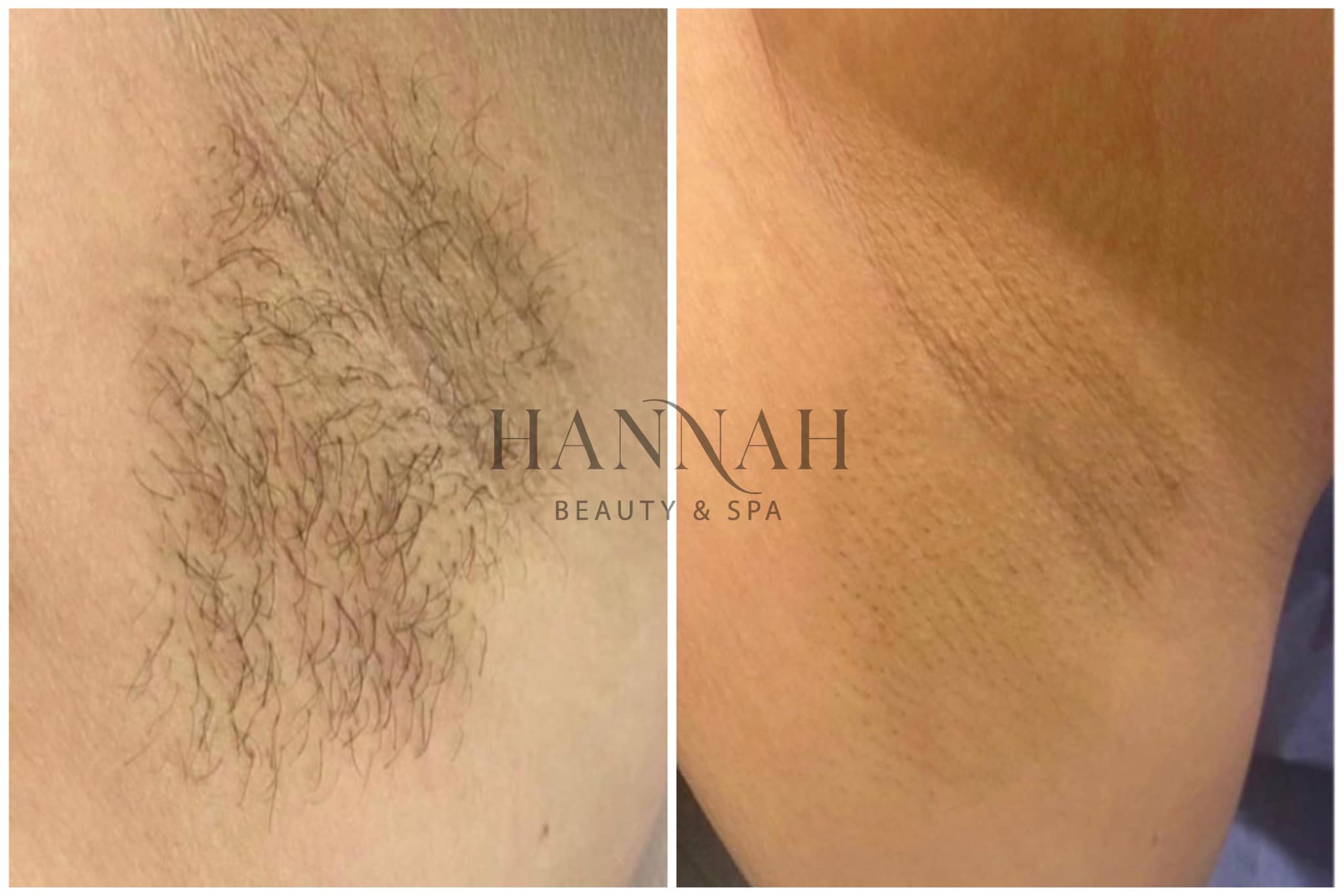 Hannah Beauty & Spa ảnh 1