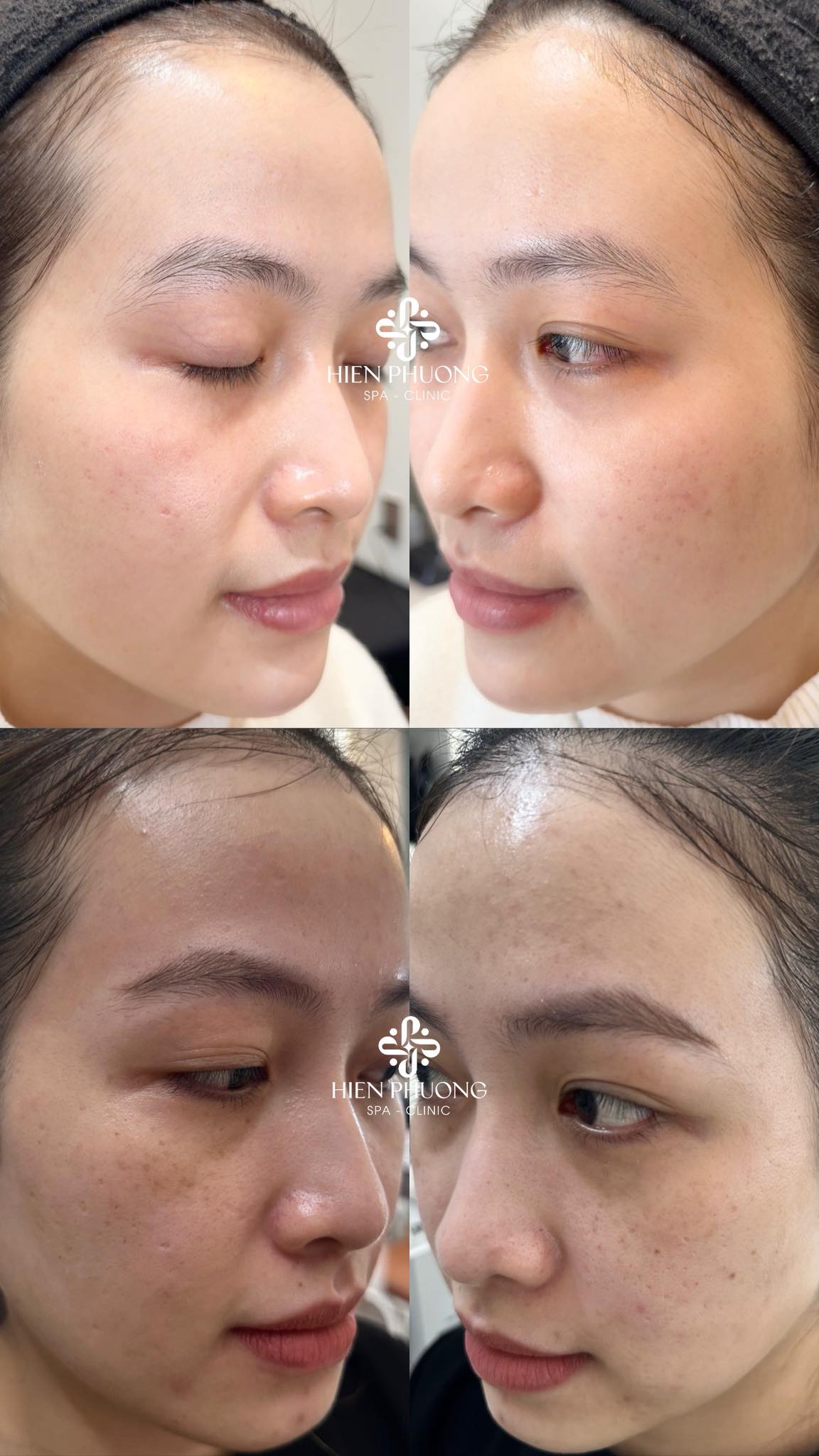 Hiền Phương Spa ảnh 2