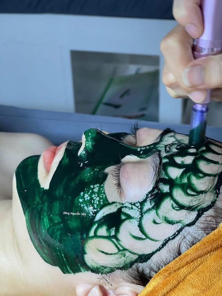 Hồng Nguyễn Spa ảnh 1