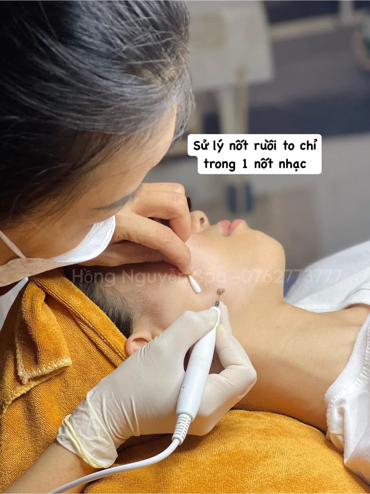 Hồng Nguyễn Spa ảnh 2
