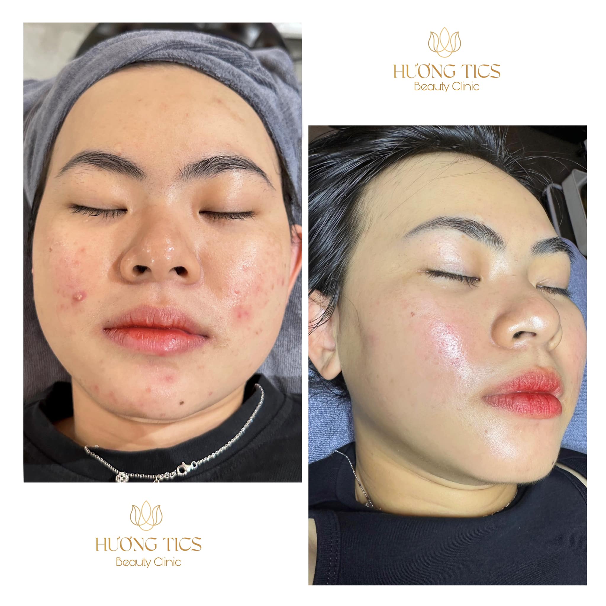 Hương Tics Beauty Clinic ảnh 2