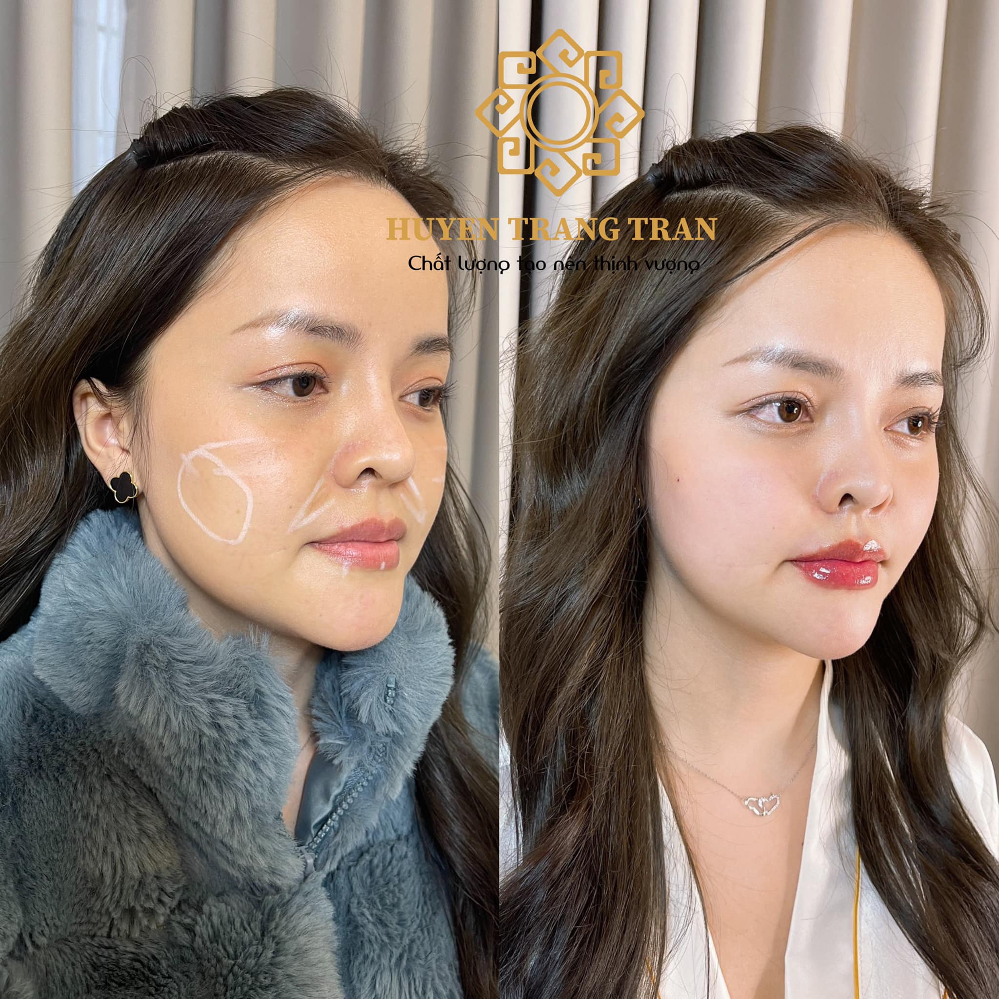 Huyen Trang Tran Beauty Center ảnh 2