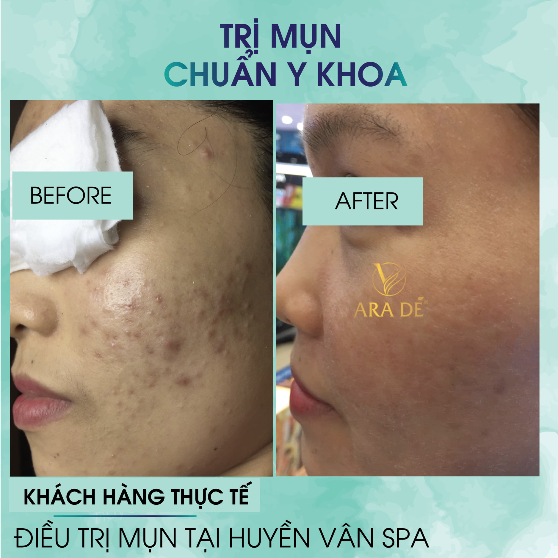 Huyền Vân Home Spa ảnh 2