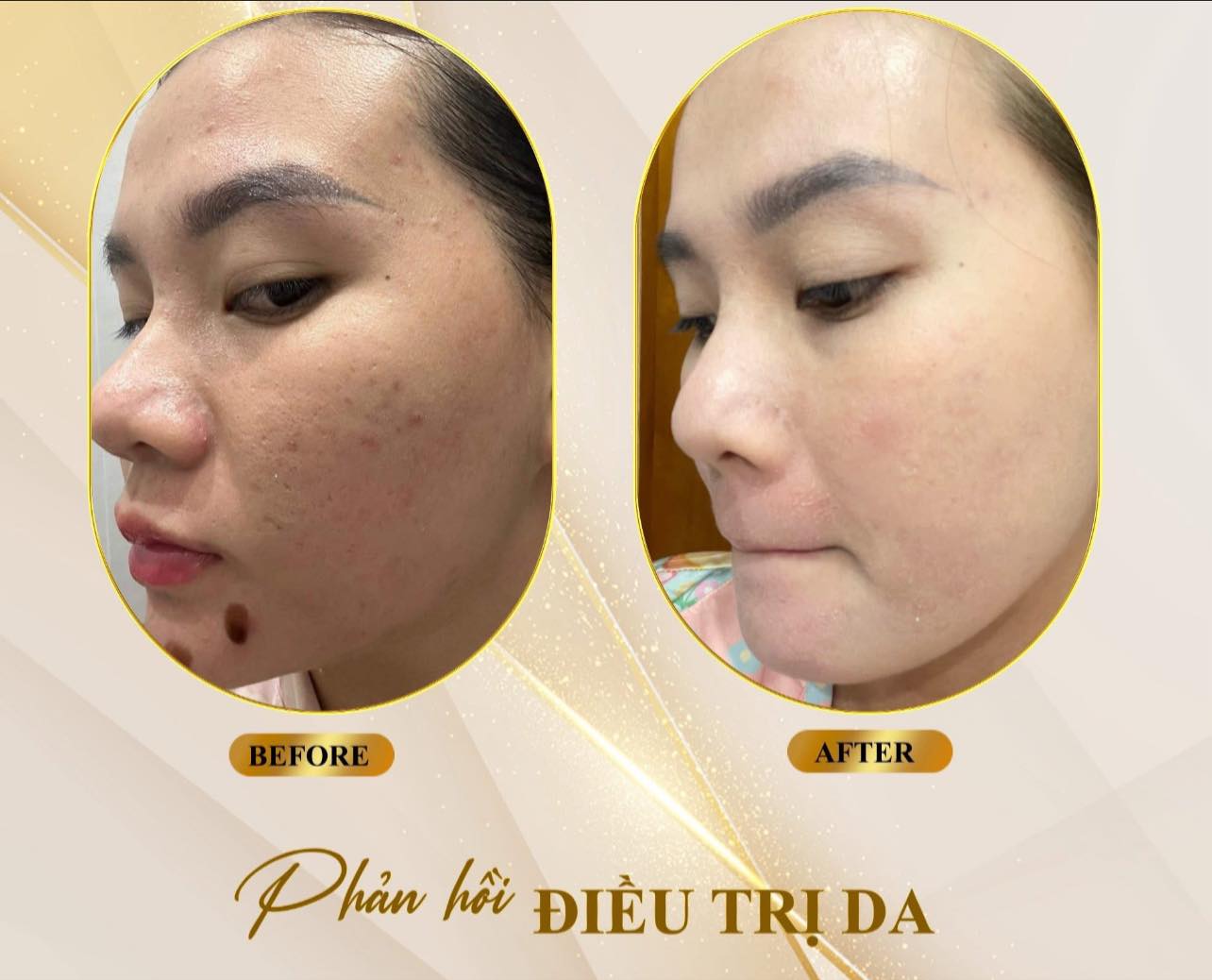 Kiều Trâm Spa & Skincare ảnh 1