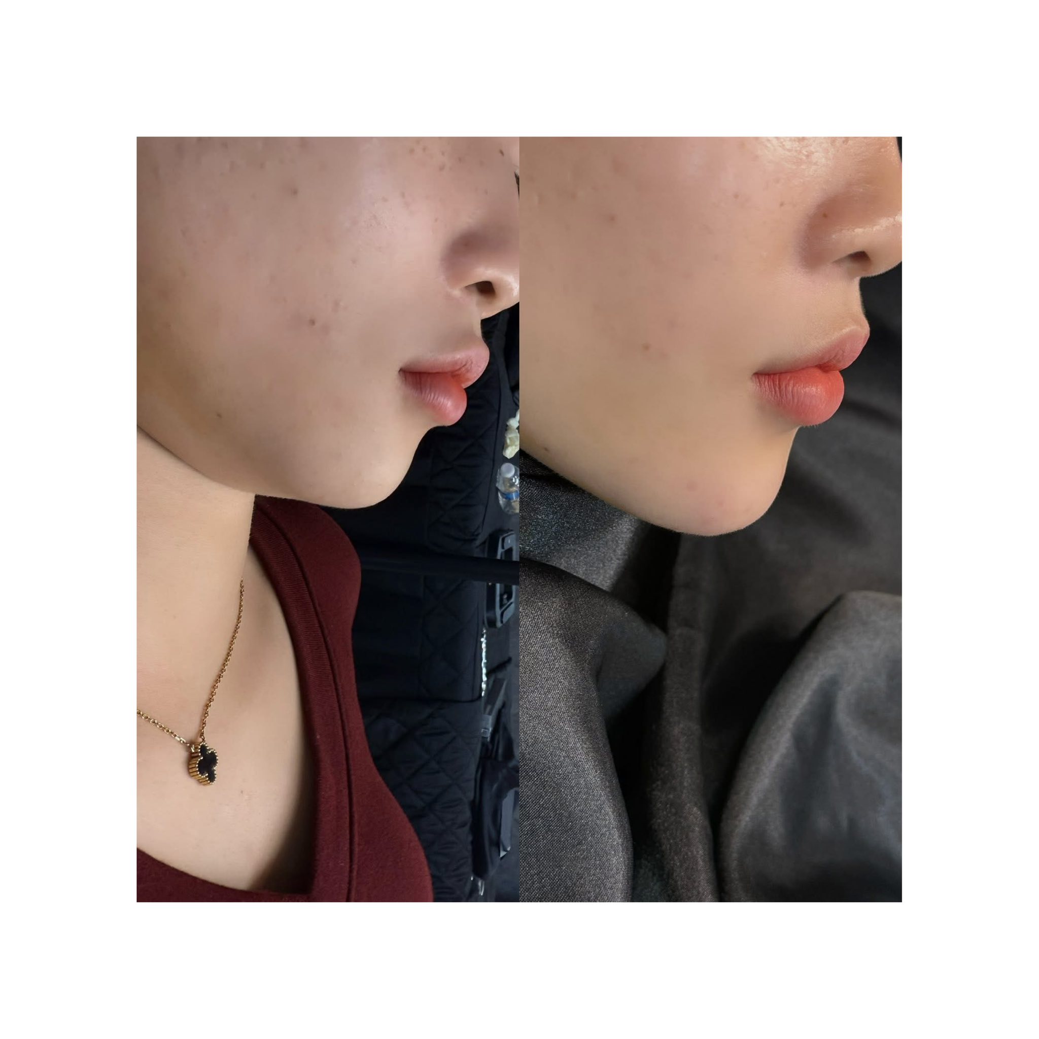 Kiều Trâm Spa & Skincare ảnh 2