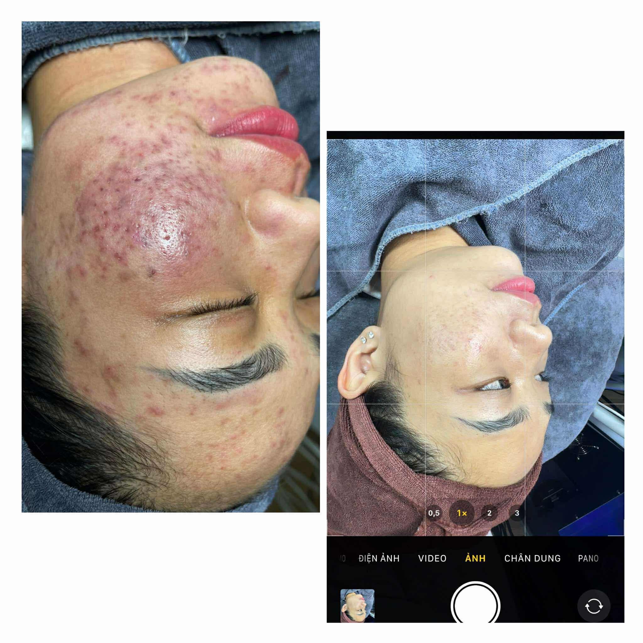 Kiều Trang Spa ảnh 2