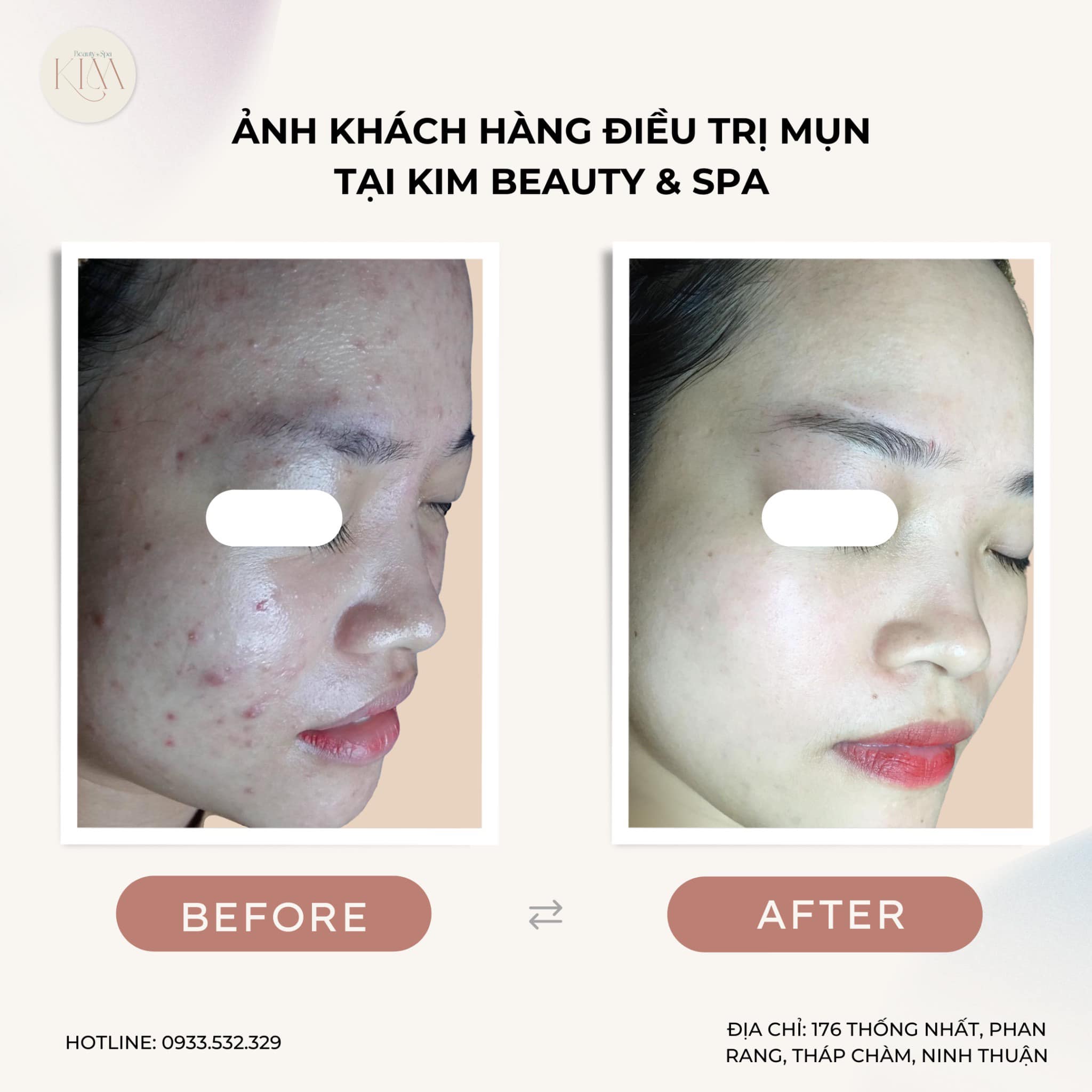 Kim Beauty Spa ảnh 1