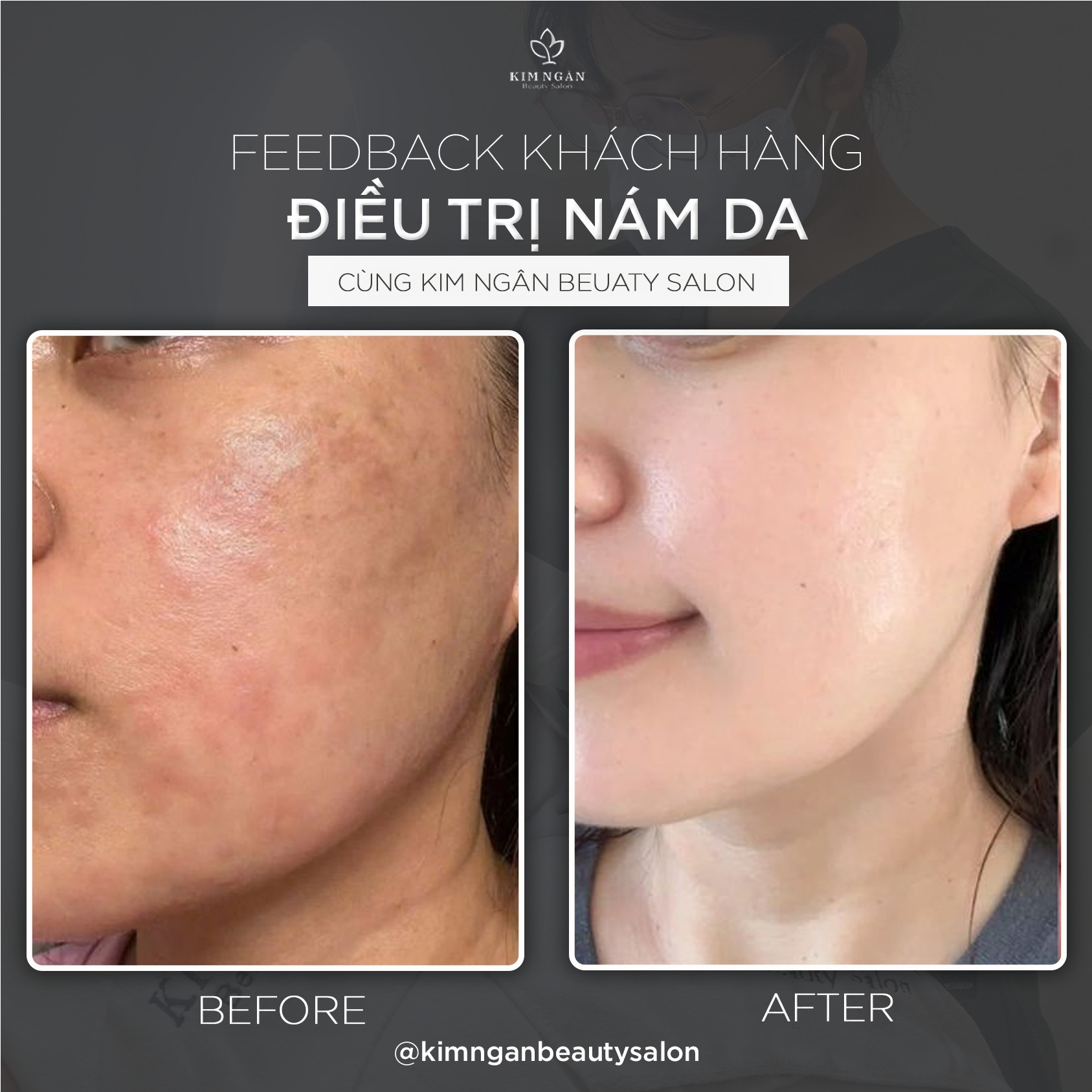 Kim Ngân Beauty Salon ảnh 1