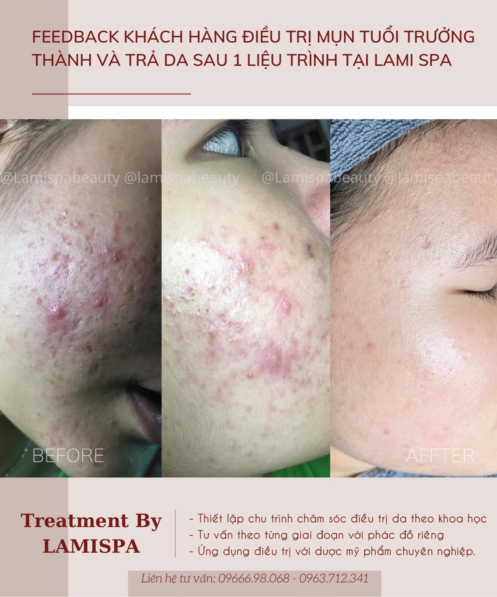 Lami Spa - Beauty & Academy ảnh 2