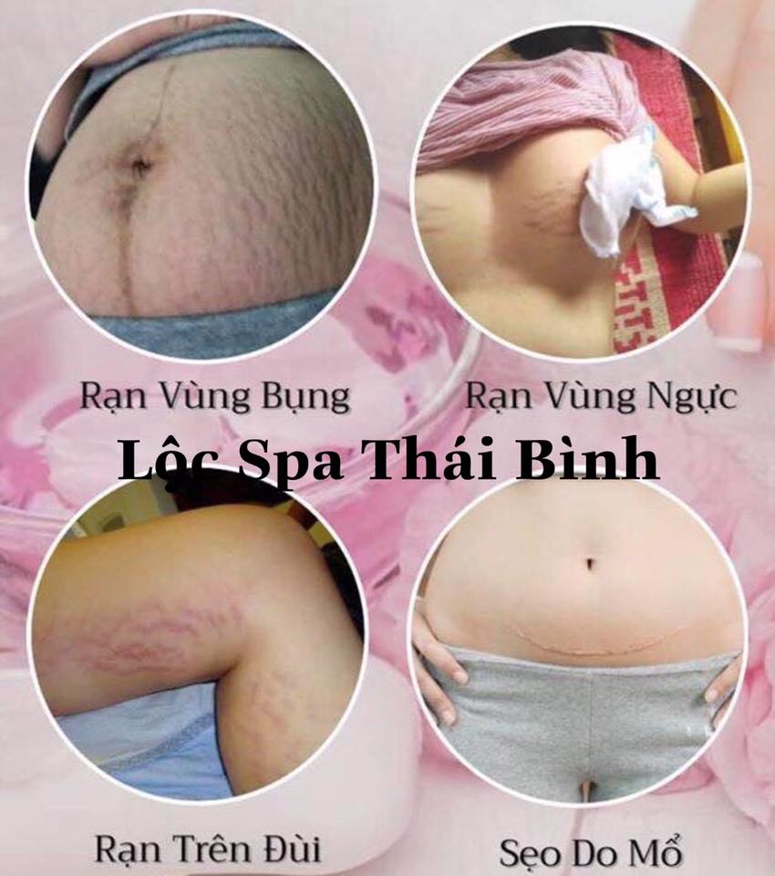 Lộc Spa Thái Bình ảnh 2