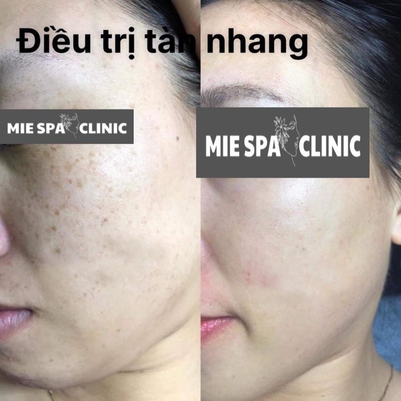 Mie Spa & Clinic ảnh 1