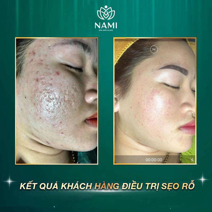 Nami Spa Beauty & Clinic ảnh 1