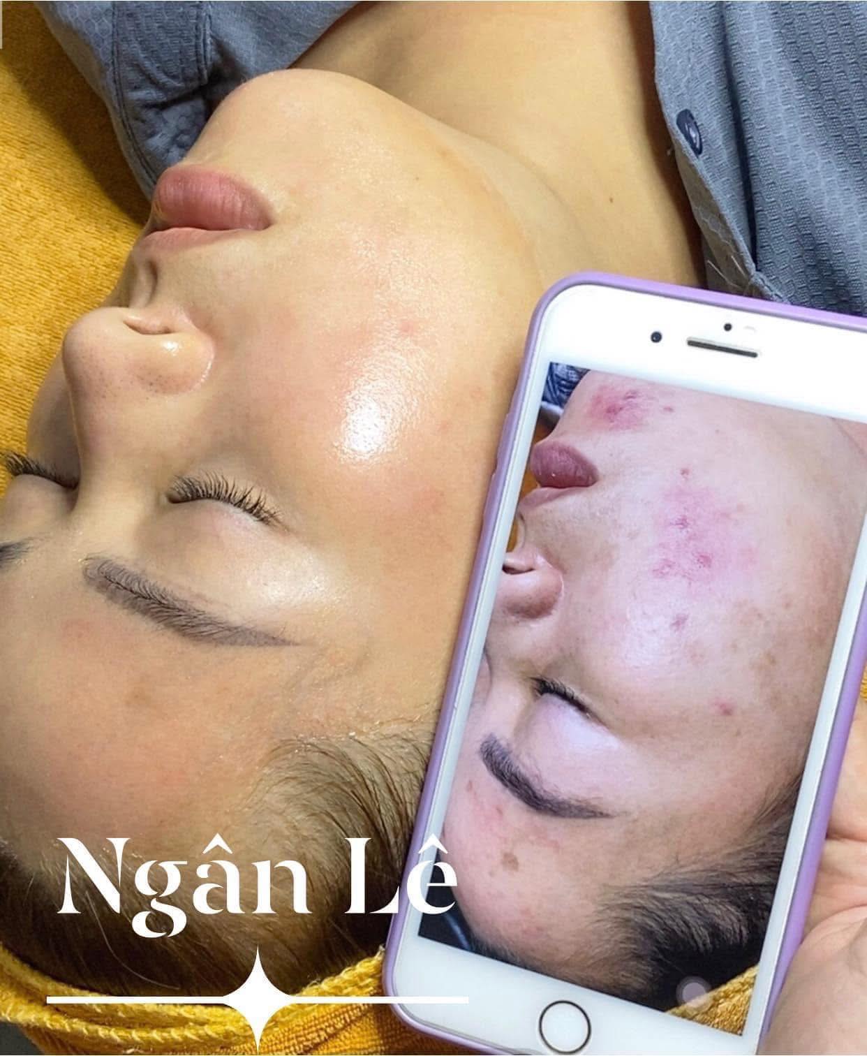 Ngân Lê Spa ảnh 1