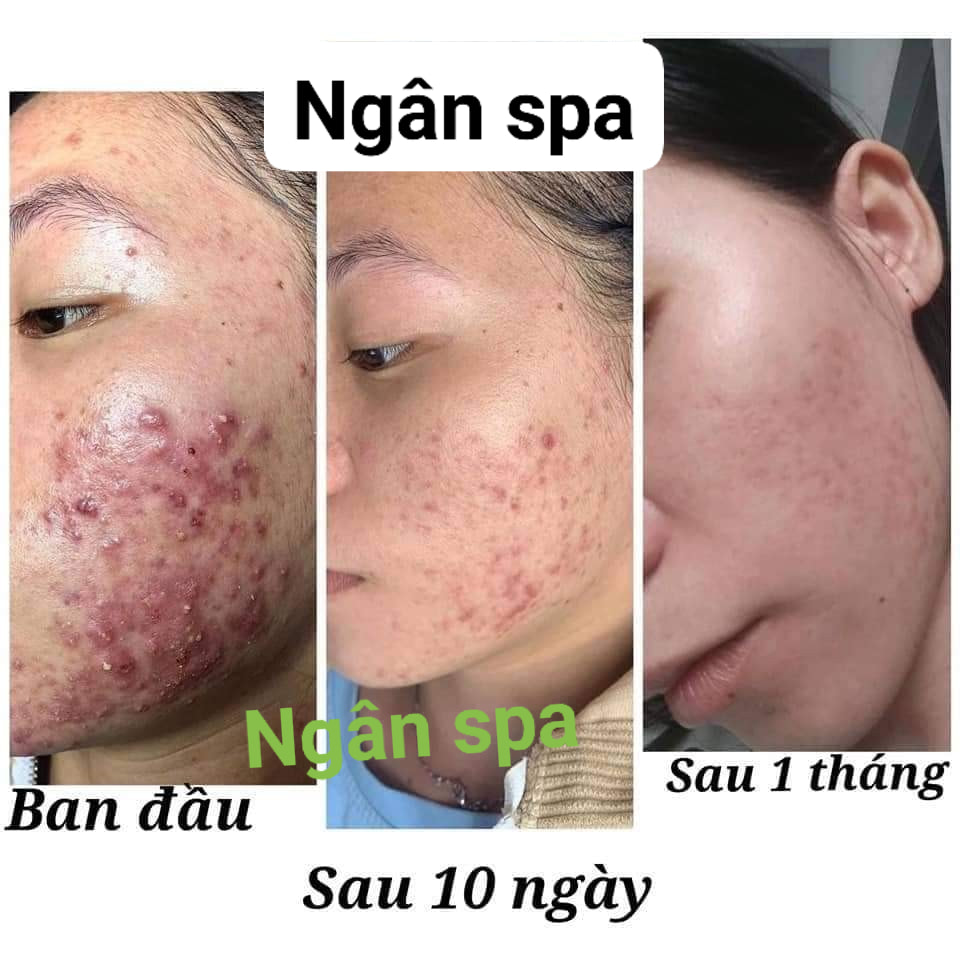 Ngân Spa ảnh 1