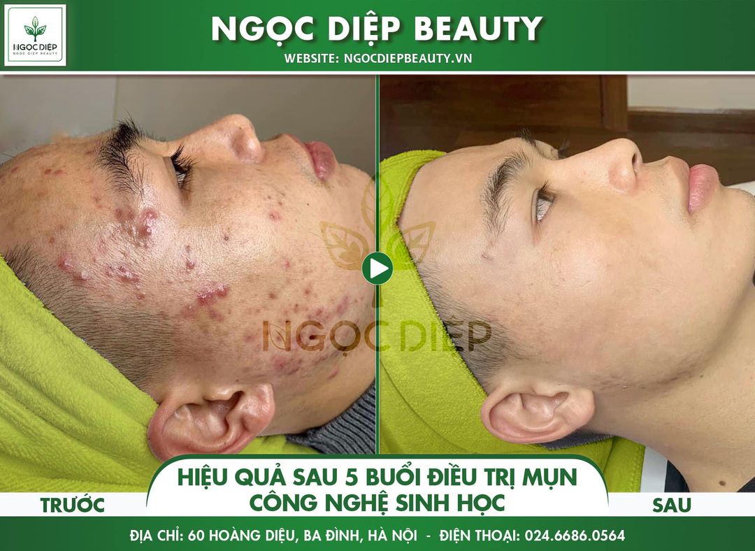 Ngọc Diệp Beauty ảnh 1