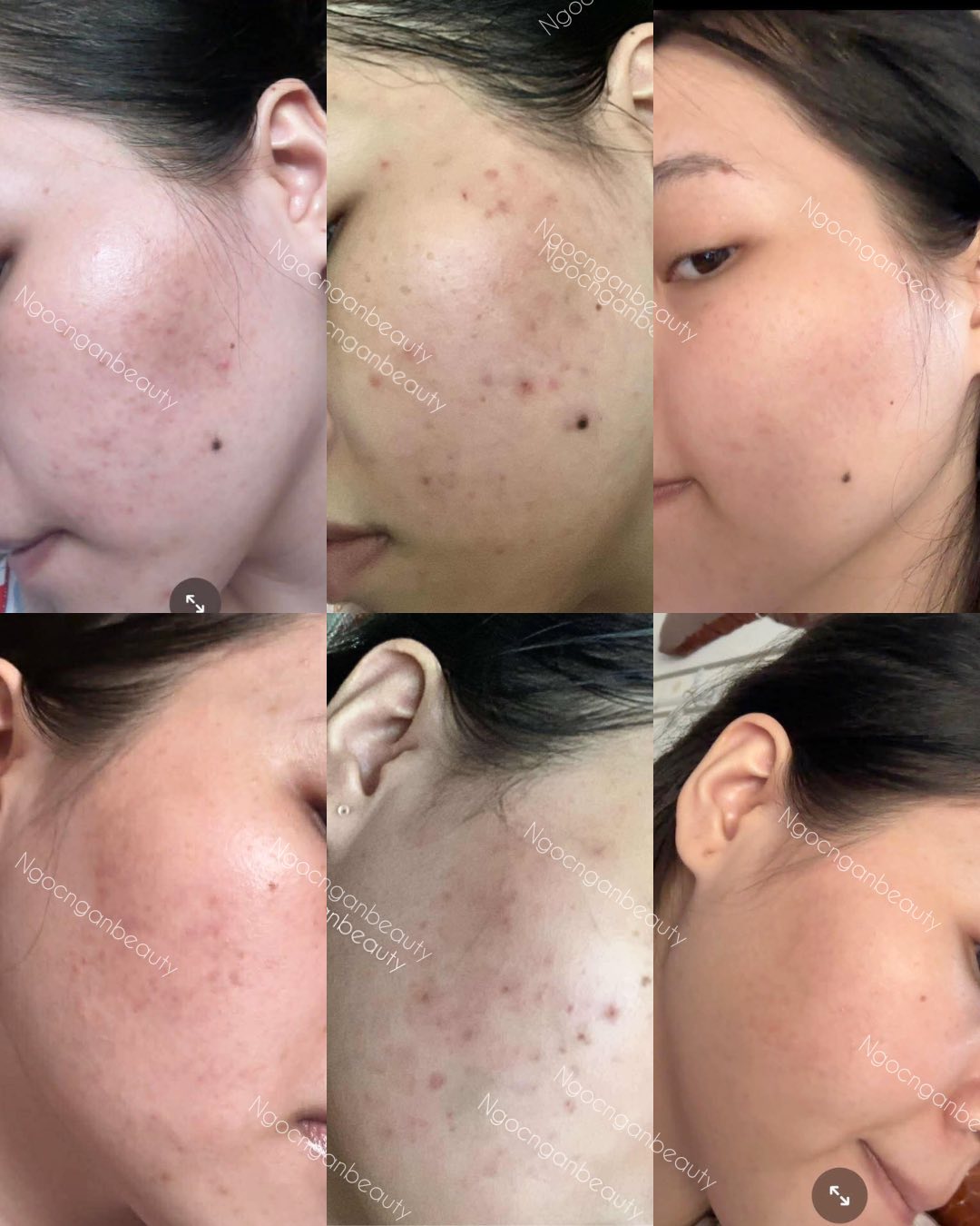 Ngọc Ngân Beauty ảnh 2