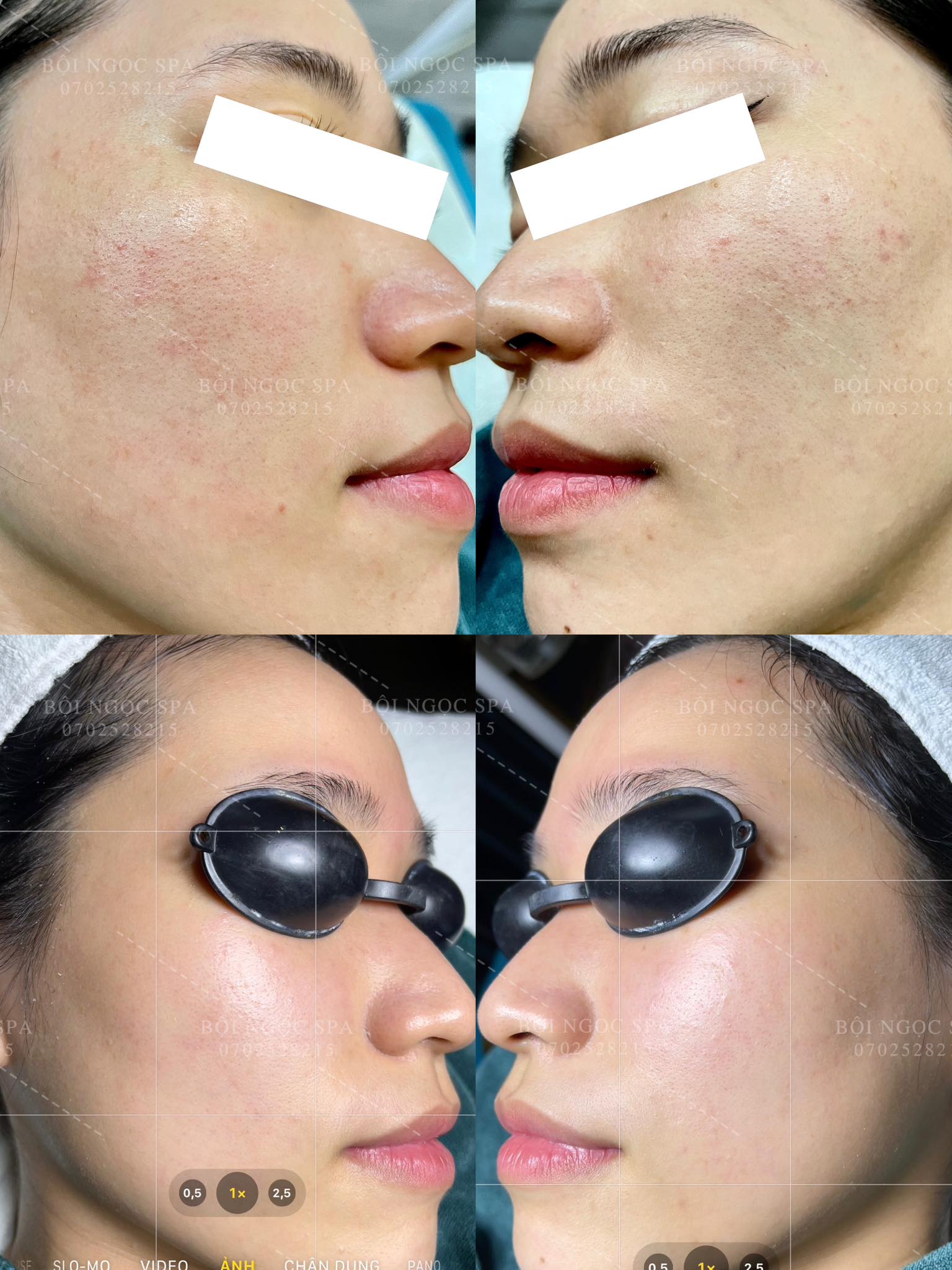 Bội Ngọc Spa ảnh 1