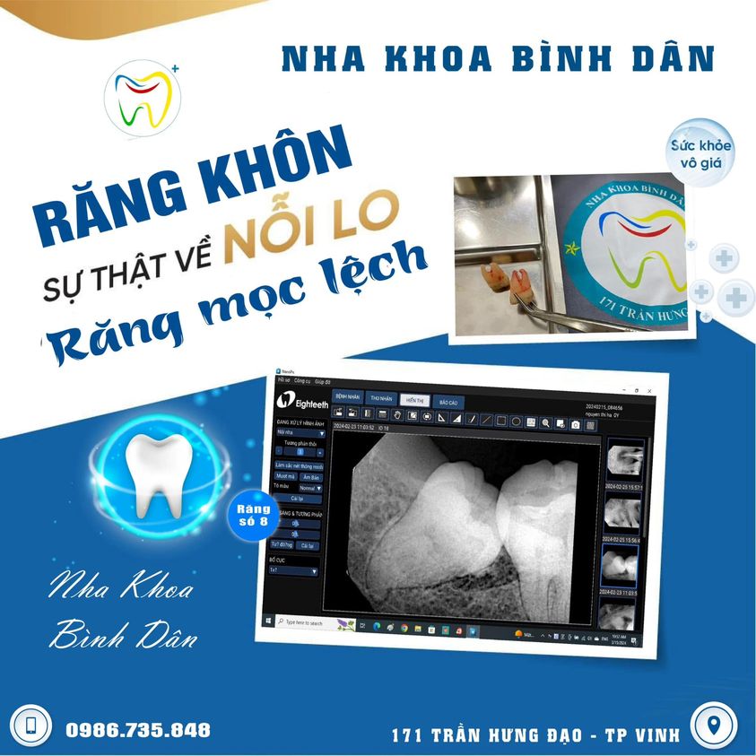 Nha Khoa Bình Dân ảnh 1