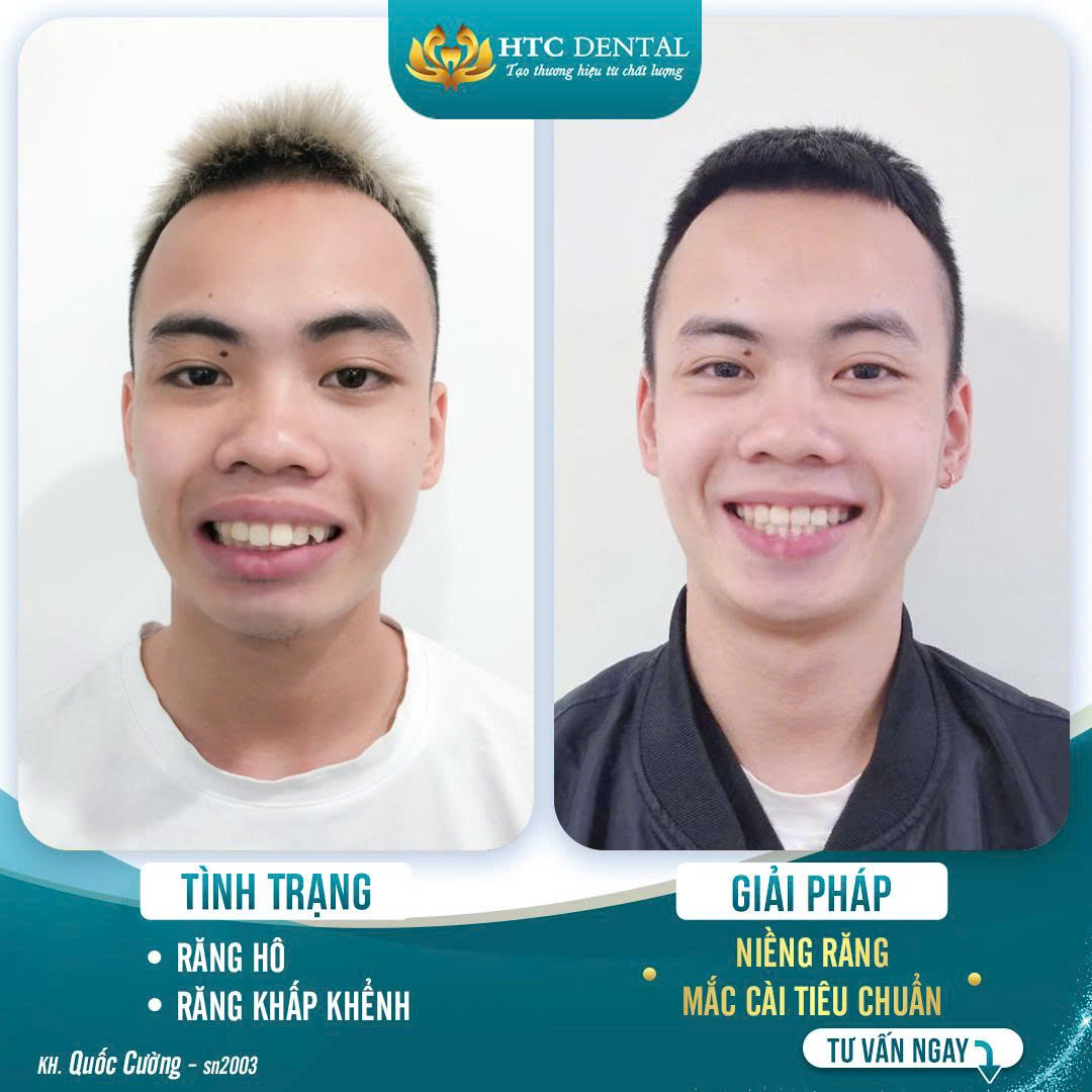Nha Khoa HTC - Viện nha khoa thẩm mỹ Hải Dương ảnh 1