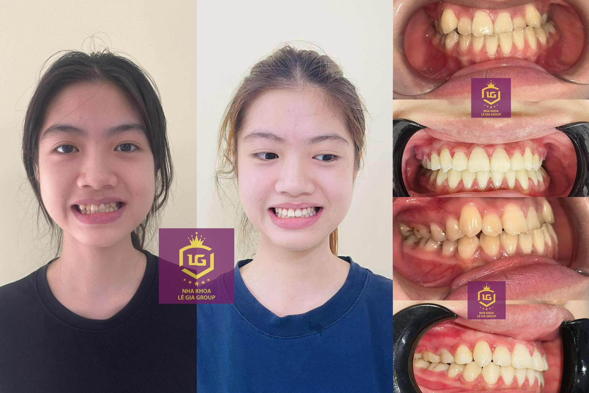 Nha Khoa Lê Gia Group - Chi nhánh Thạch Lỗi Sóc Sơn ảnh 2