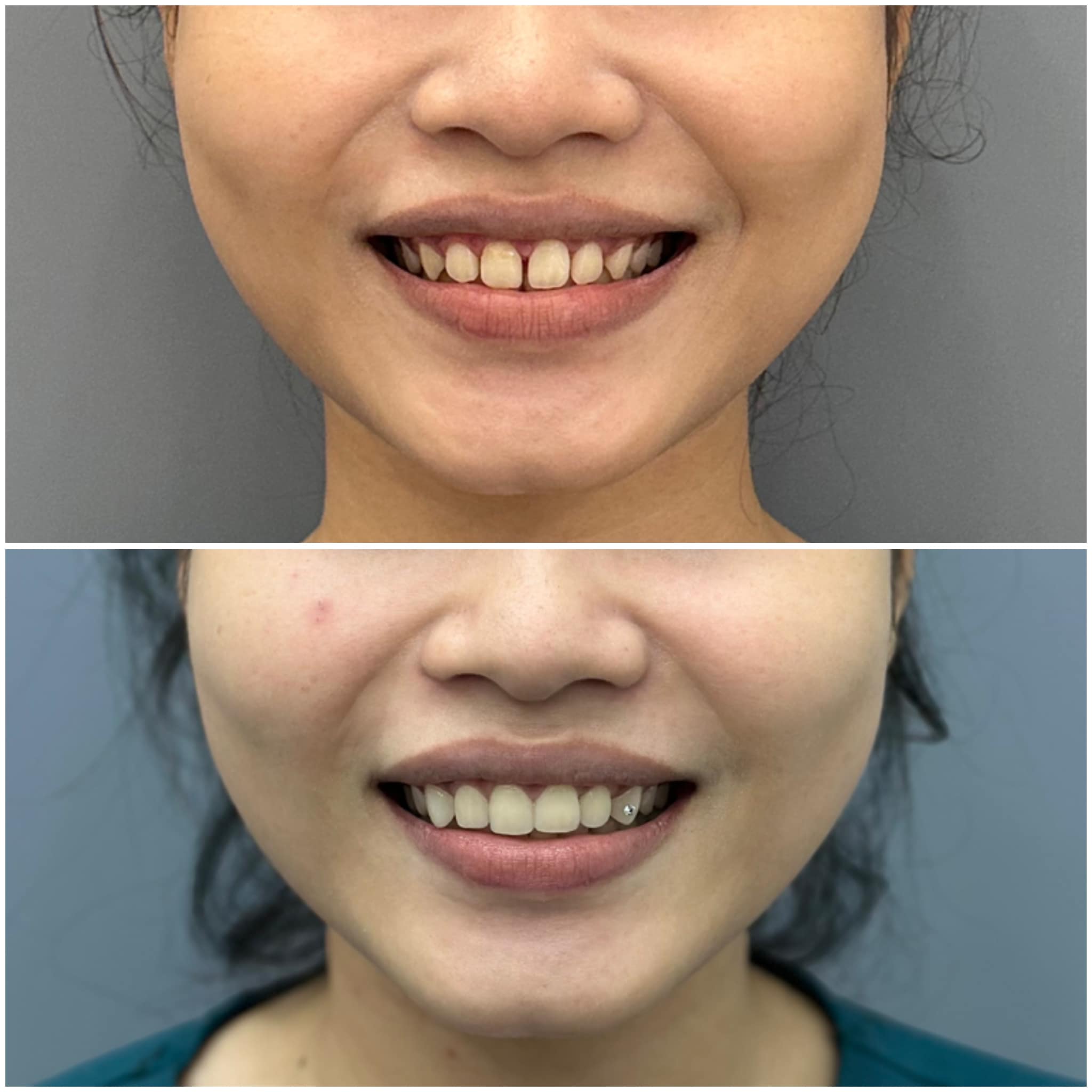 Nha Khoa Mỹ Hằng - Phòng khám Tim Mạch ảnh 2