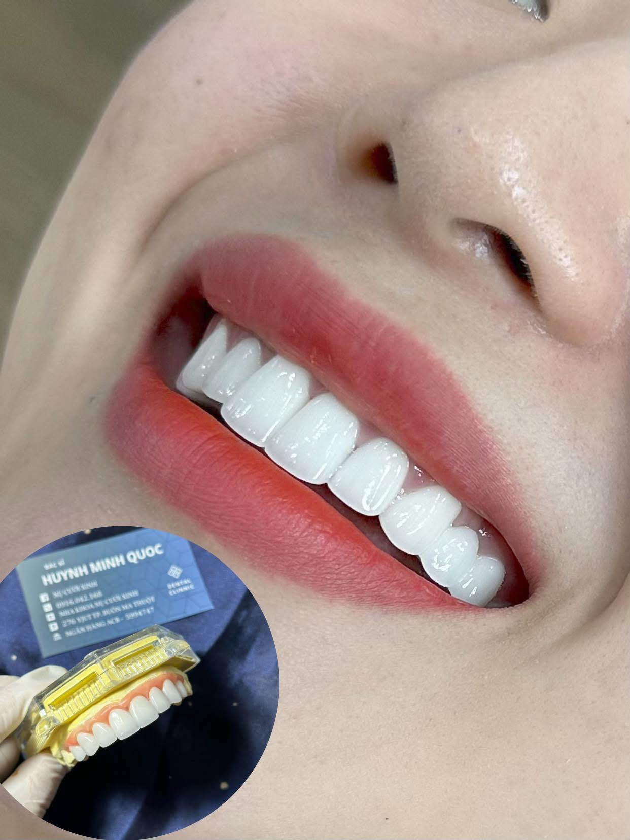 Nha Khoa Nụ Cười Xinh ảnh 2