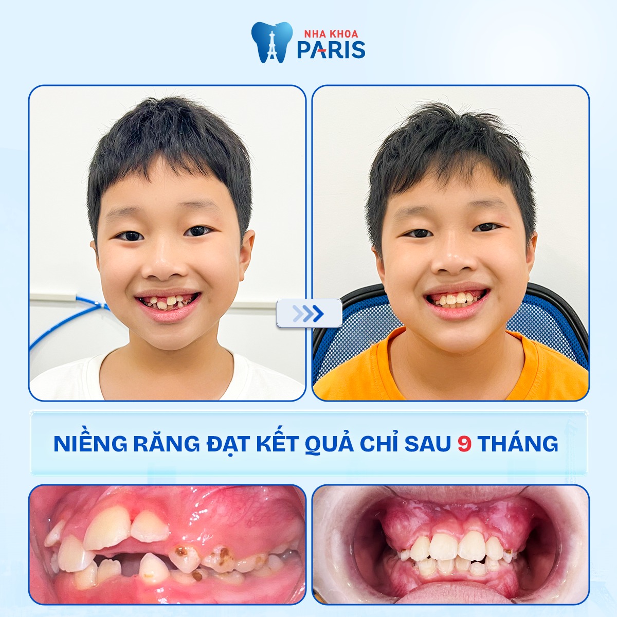 Nha Khoa Paris ảnh 1