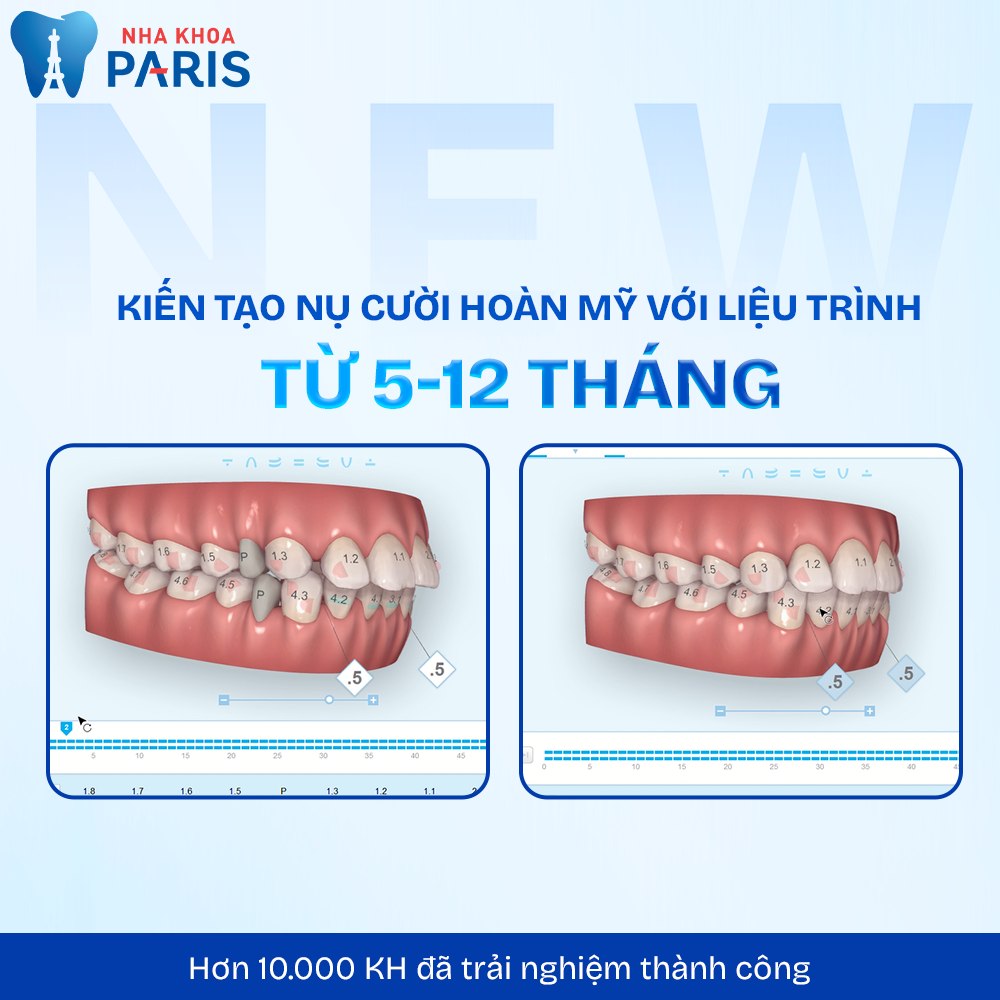 Nha Khoa Paris (Vinh, Nghệ An) ảnh 2