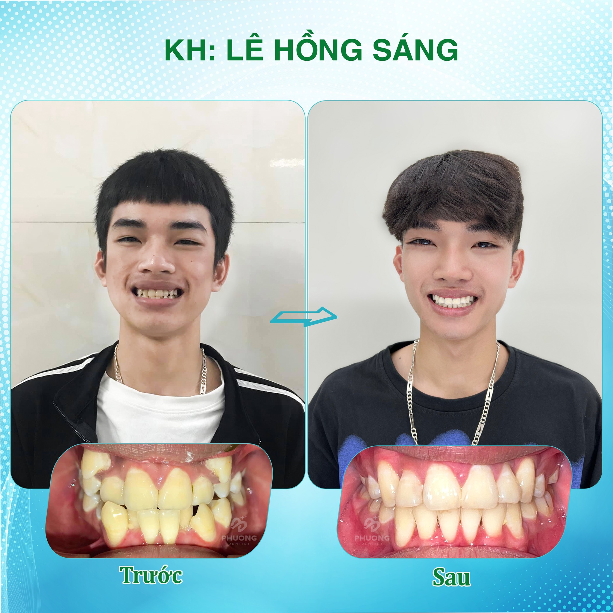 Nha Khoa Phương Dentist ảnh 2