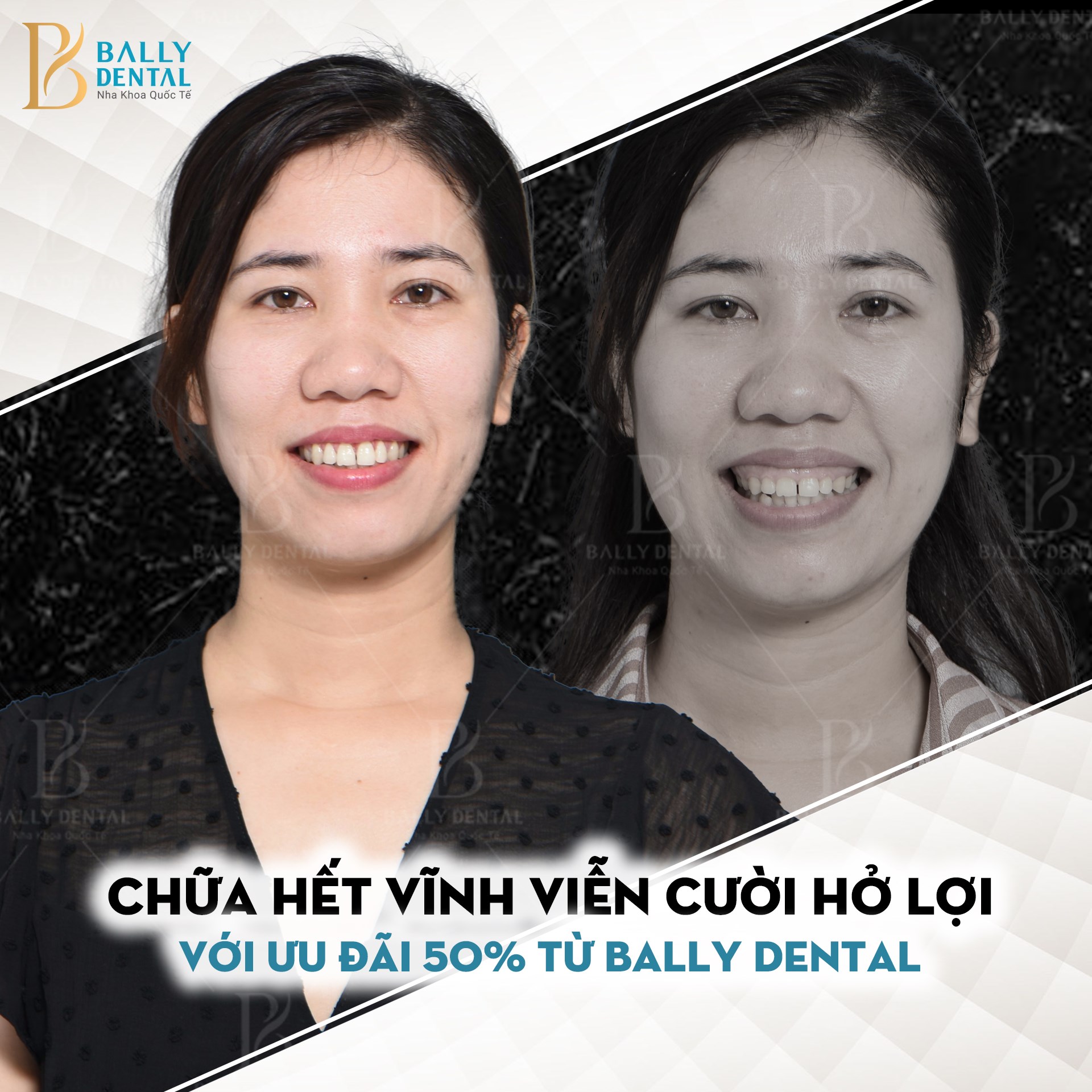 Nha Khoa Quốc Tế Bally ảnh 2