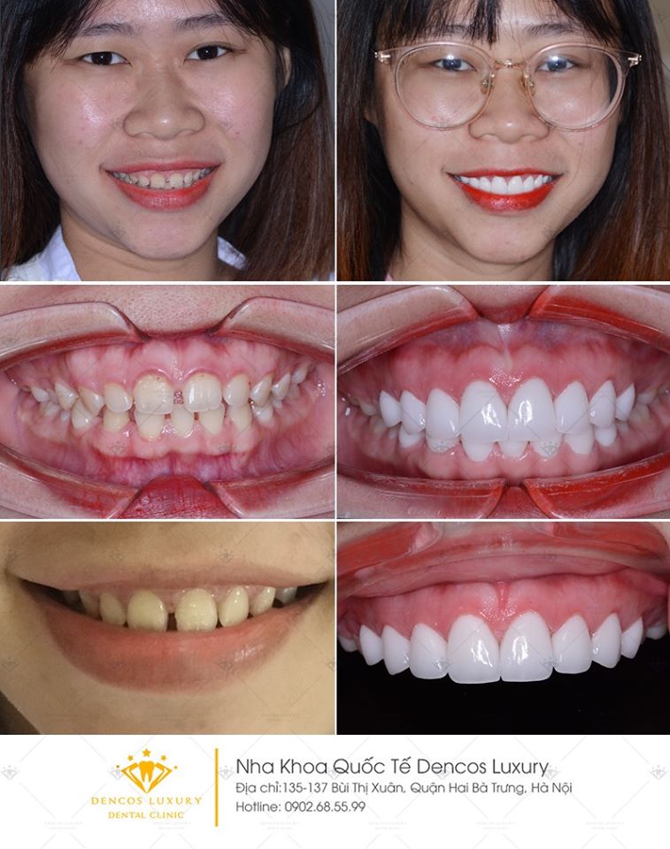 Nha Khoa Quốc Tế Dencos Luxury ảnh 2