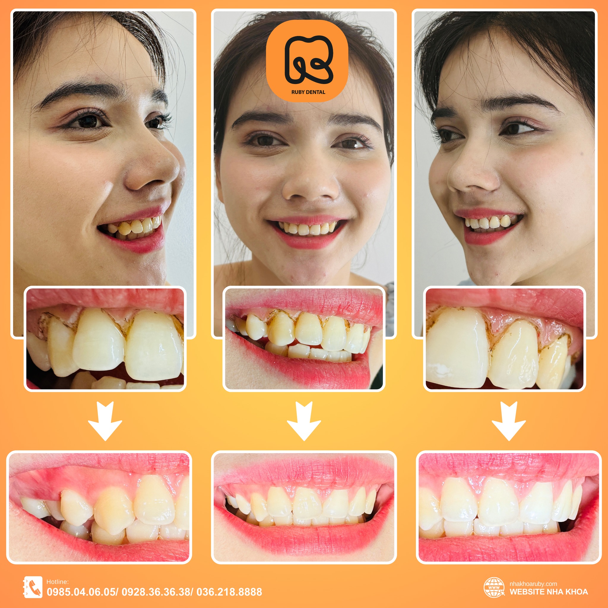 Nha Khoa Quốc Tế Ruby Dental ảnh 2