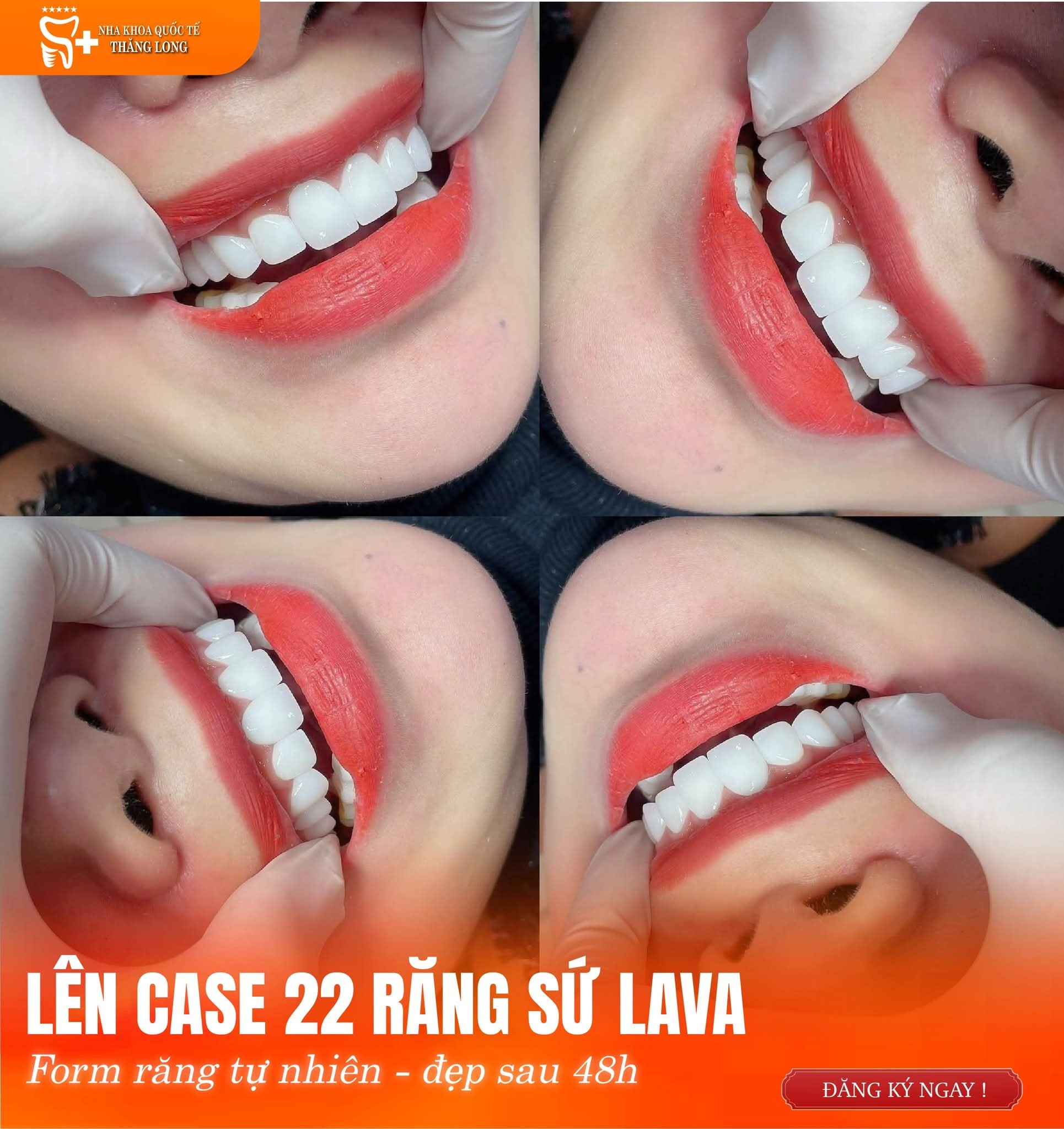 Nha Khoa Quốc Tế Thăng Long - Mỹ Tho ảnh 1