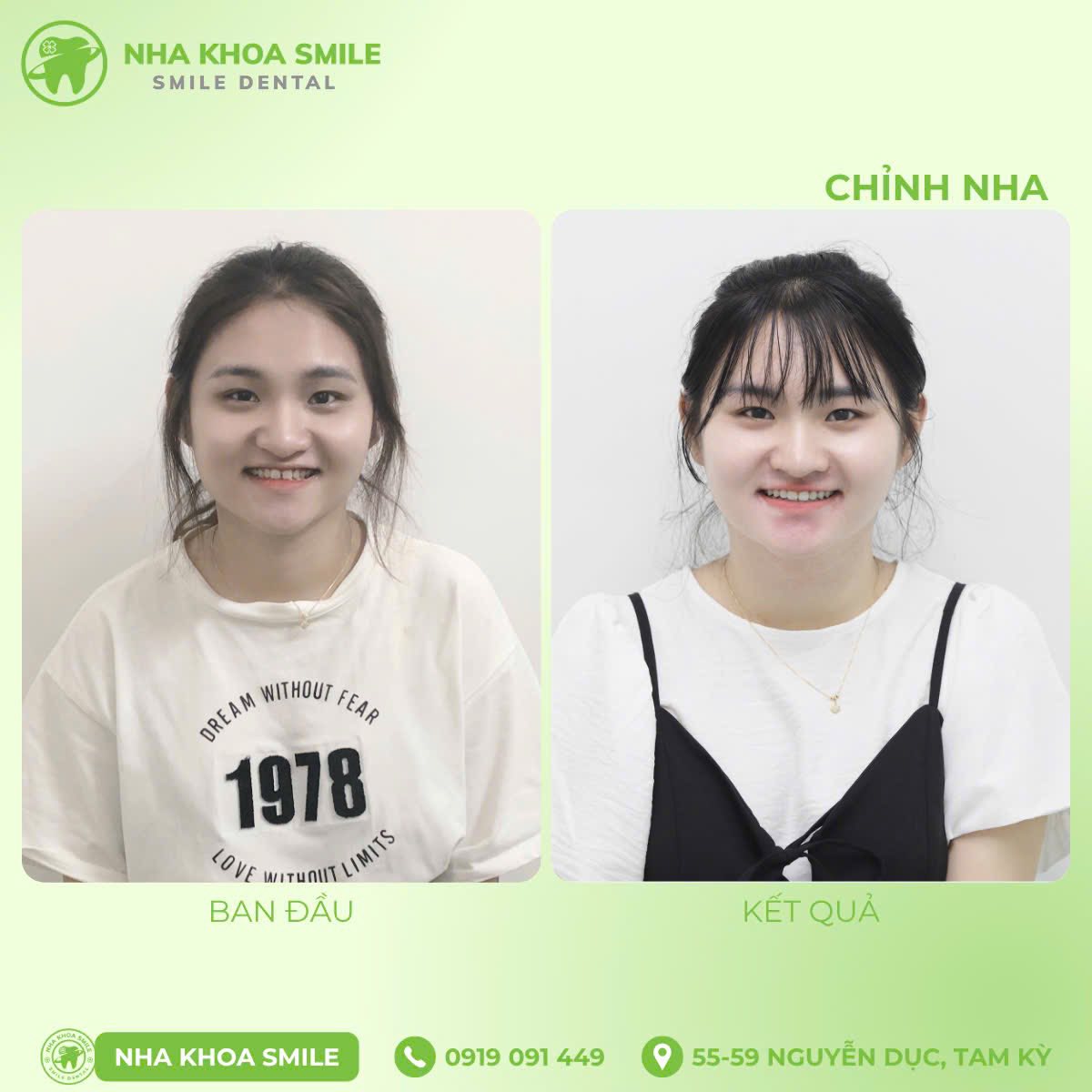 Nha Khoa Smile Tam Kỳ ảnh 2