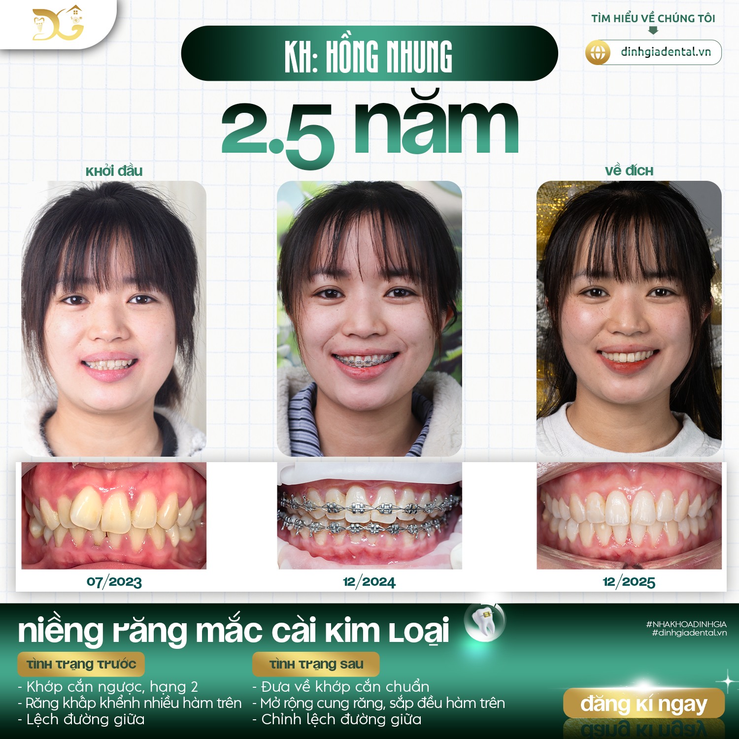 Nha khoa Đinh Gia ảnh 1
