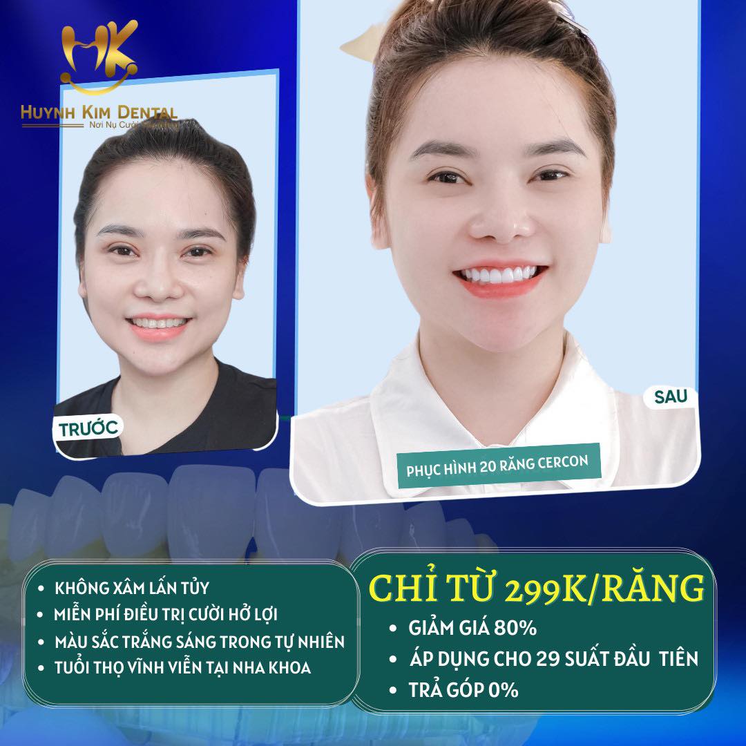 Nha Khoa Thẩm Mỹ Quy Nhơn - Huỳnh Kim Dental ảnh 1