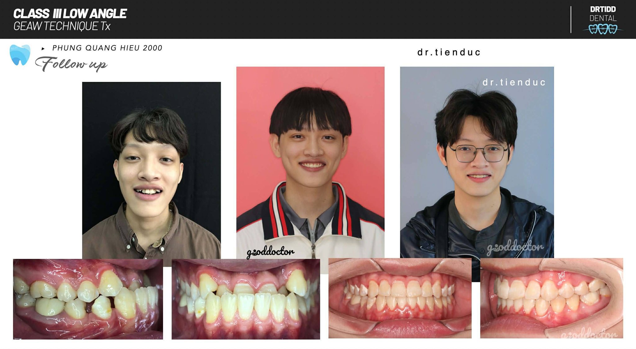 Nha Khoa Tiến Đức (Drtidd Dental Clinic) ảnh 2