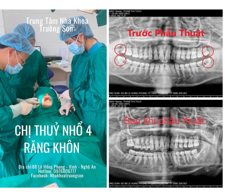 Nha Khoa Trường Sơn ảnh 1