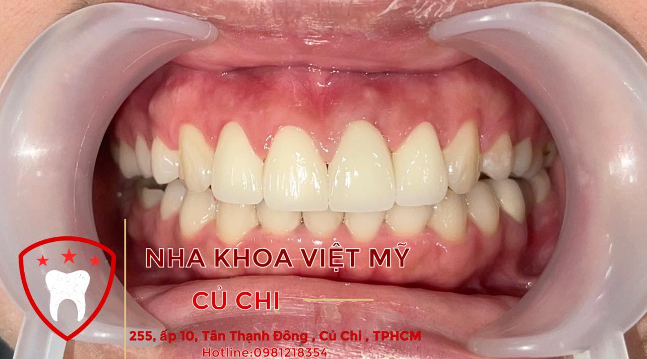 Nha Khoa Việt Mỹ Củ Chi ảnh 2