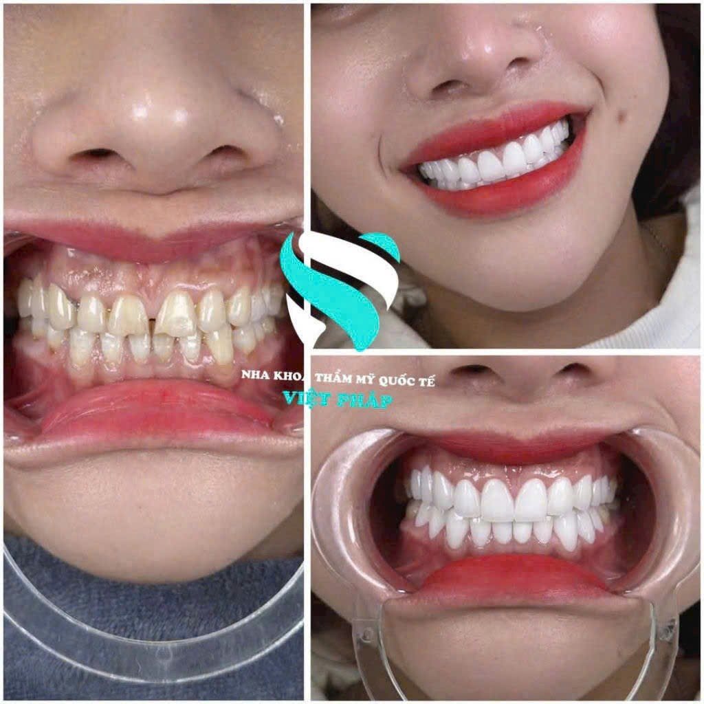 Nha Khoa Việt Pháp Dental - Nha Trang ảnh 2