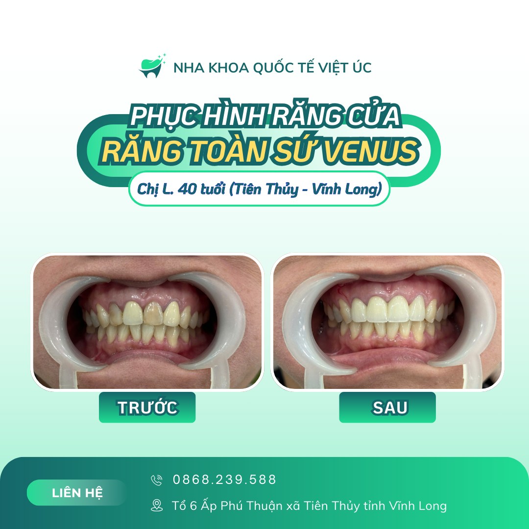 Nha Khoa Việt Úc Bến Tre ảnh 2