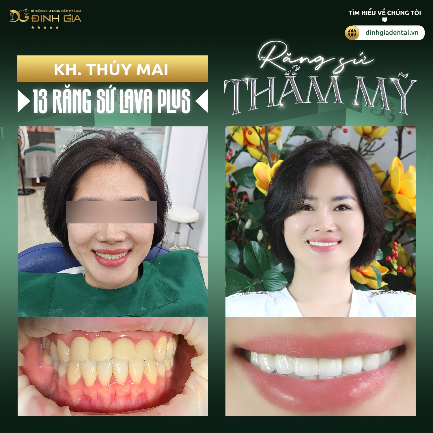 Nha khoa Đinh Gia ảnh 2