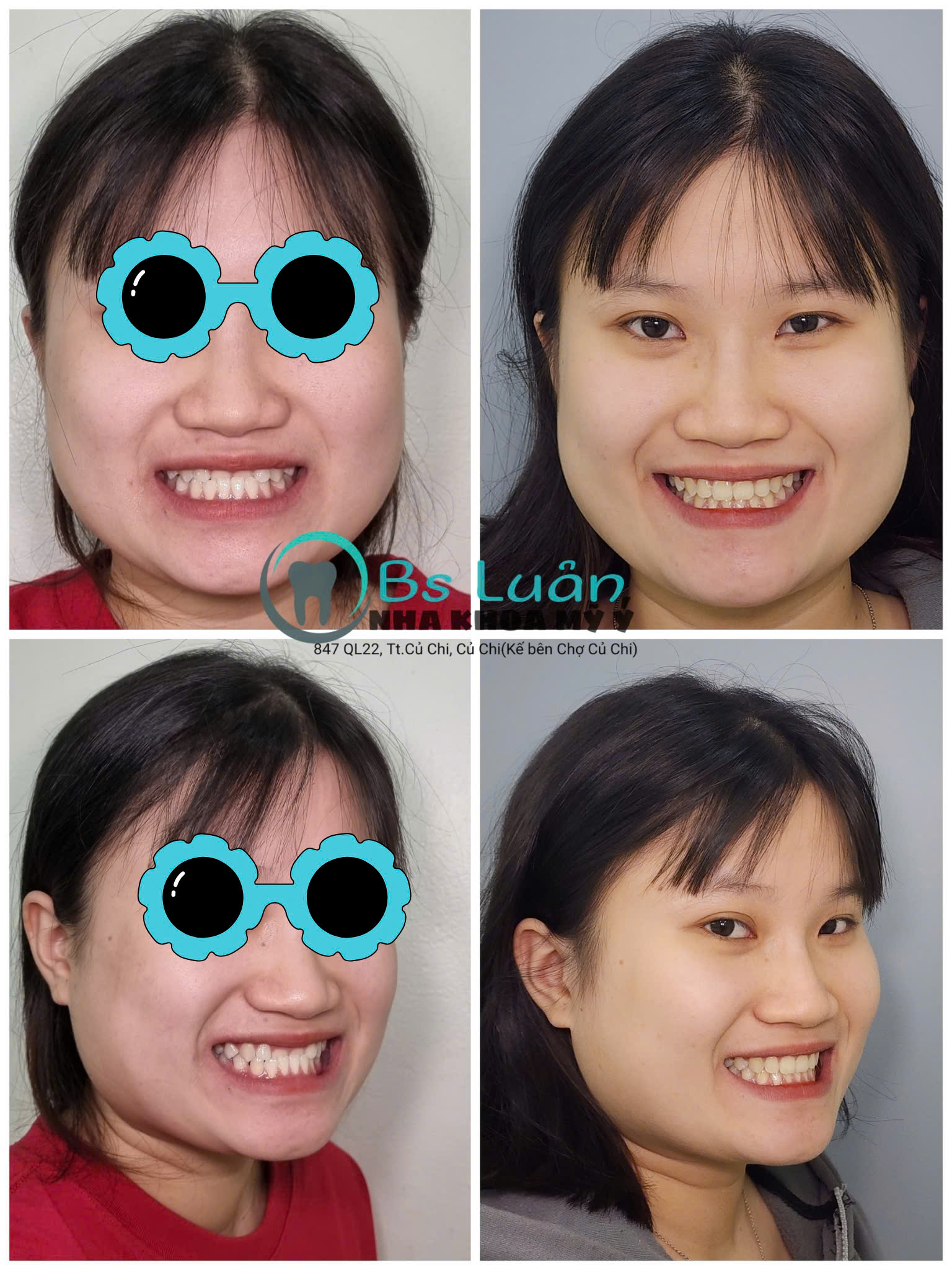 Nha khoa Mỹ Ý ảnh 3