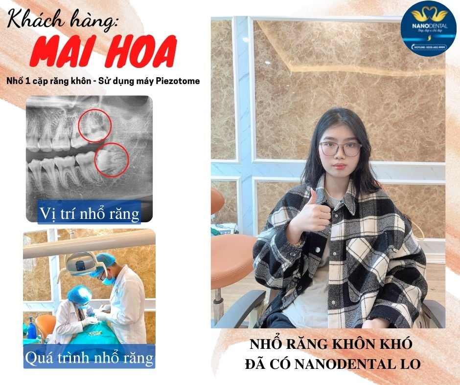 Nha khoa NanoDental ảnh 2