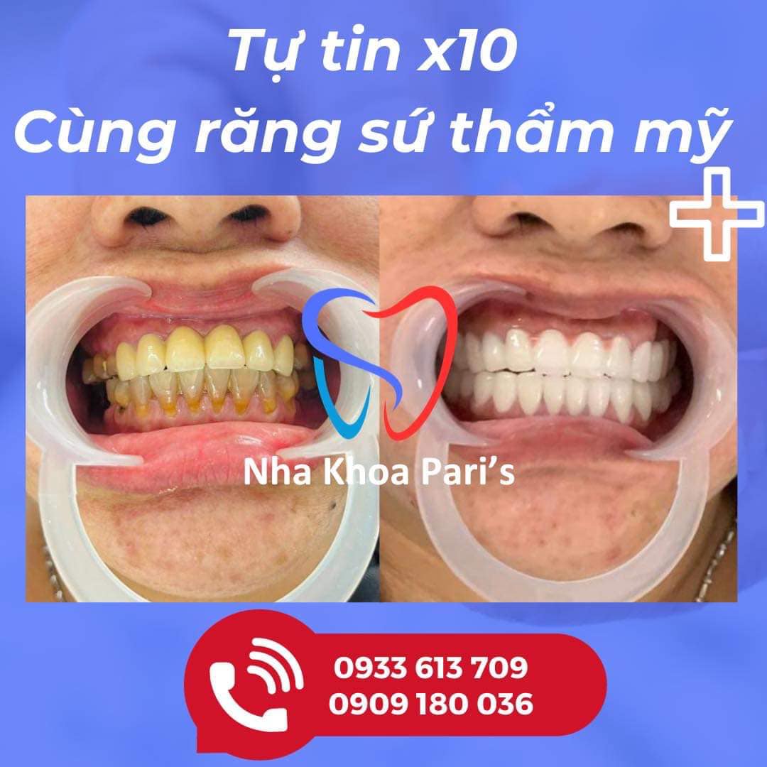 Nha khoa Pari's ảnh 2