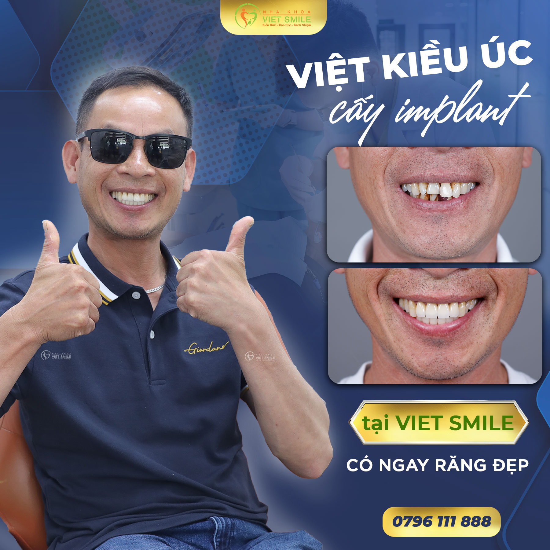 Nha khoa VIET SMILE ảnh 2