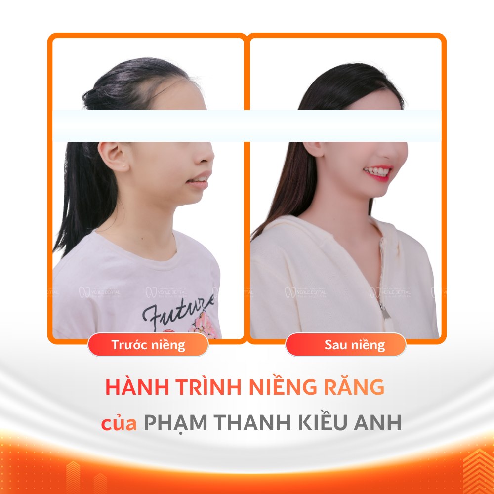 Nha khoa Yenle Dental ảnh 2