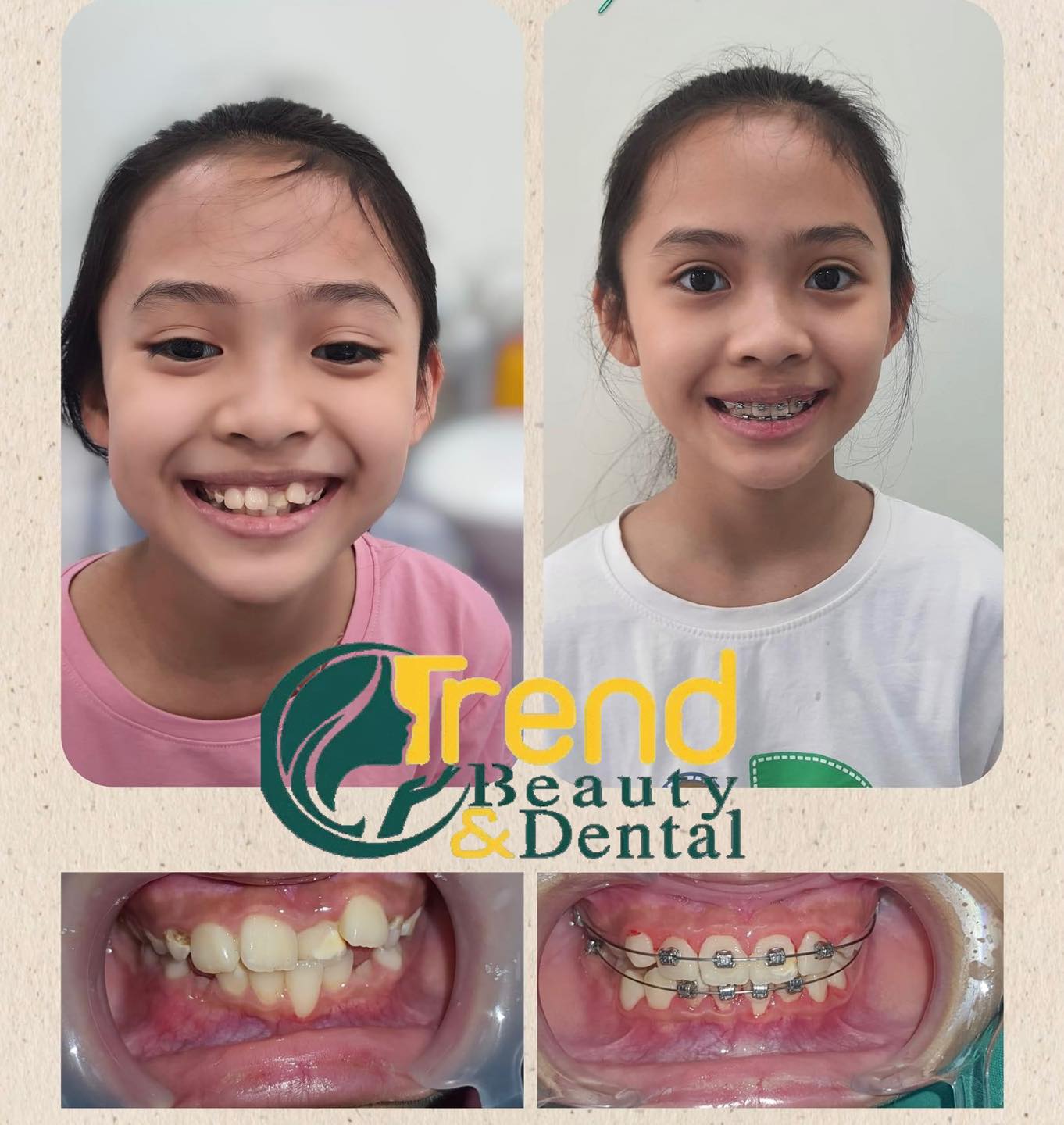 Nha khoa quốc tế Trend Dental ảnh 2