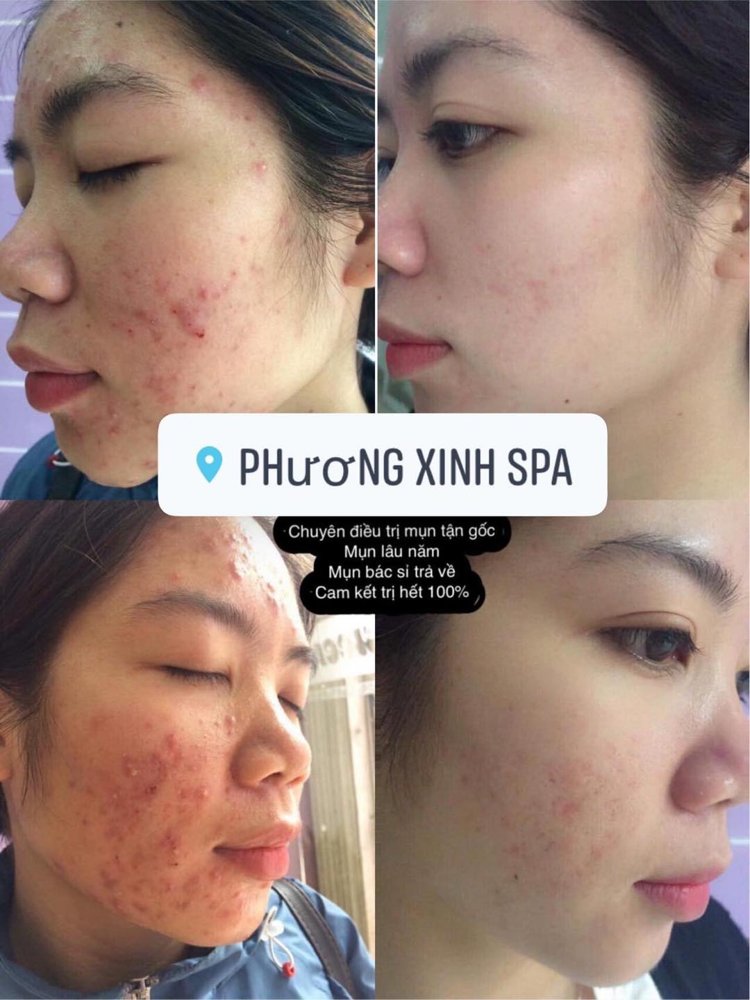 Phương Xinh Spa ảnh 2